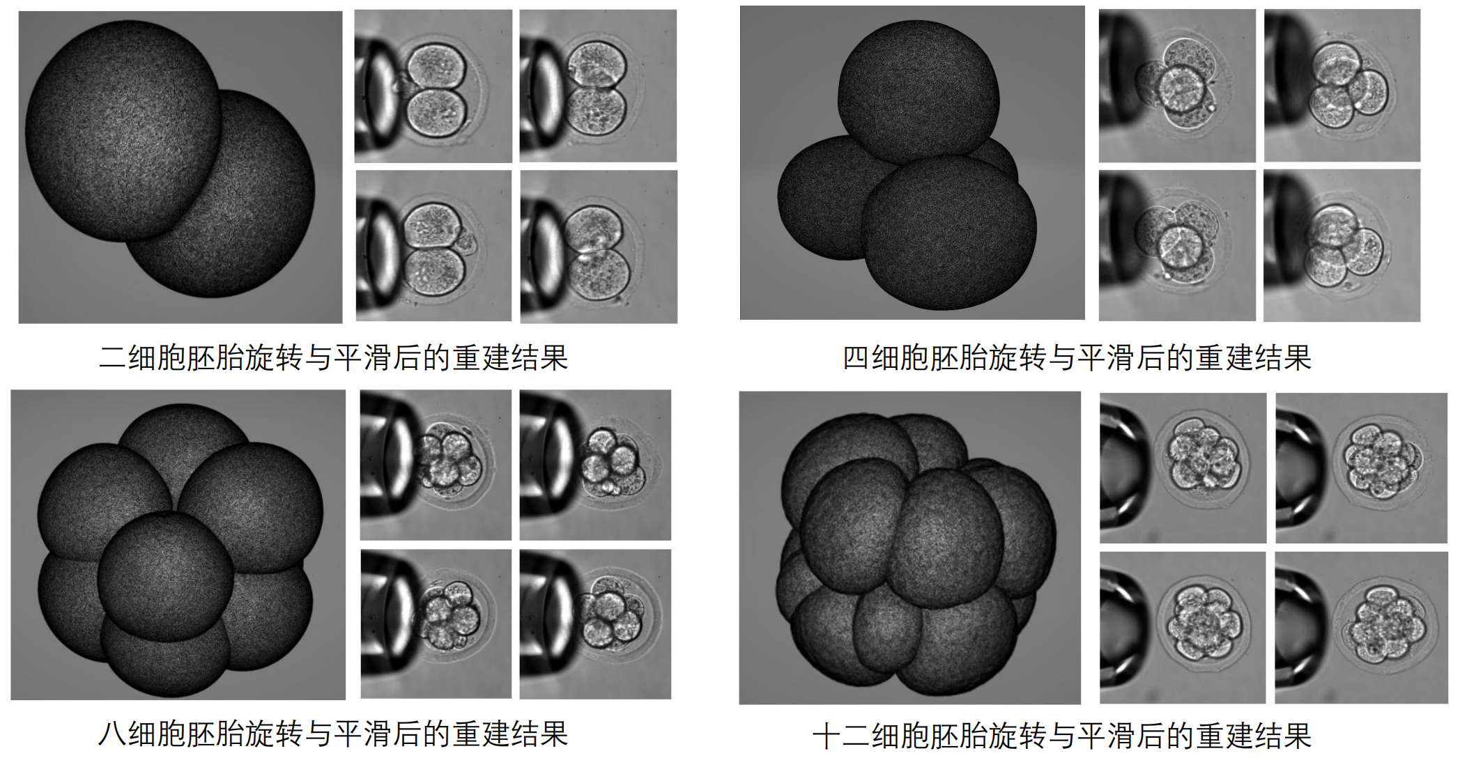 设备用于基于胚胎三维重建的形态学诊断.png
